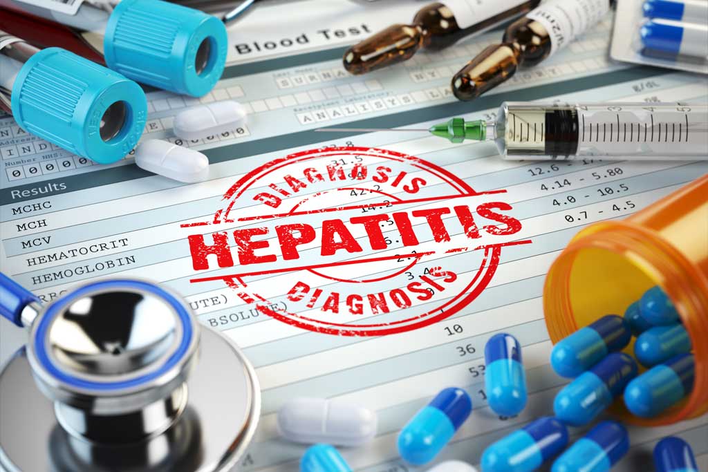 Everything You Need to Know If You Are Diagnosed with Hepatitis B