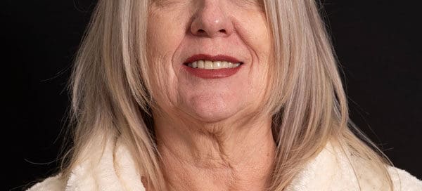 Julie Olson, RD